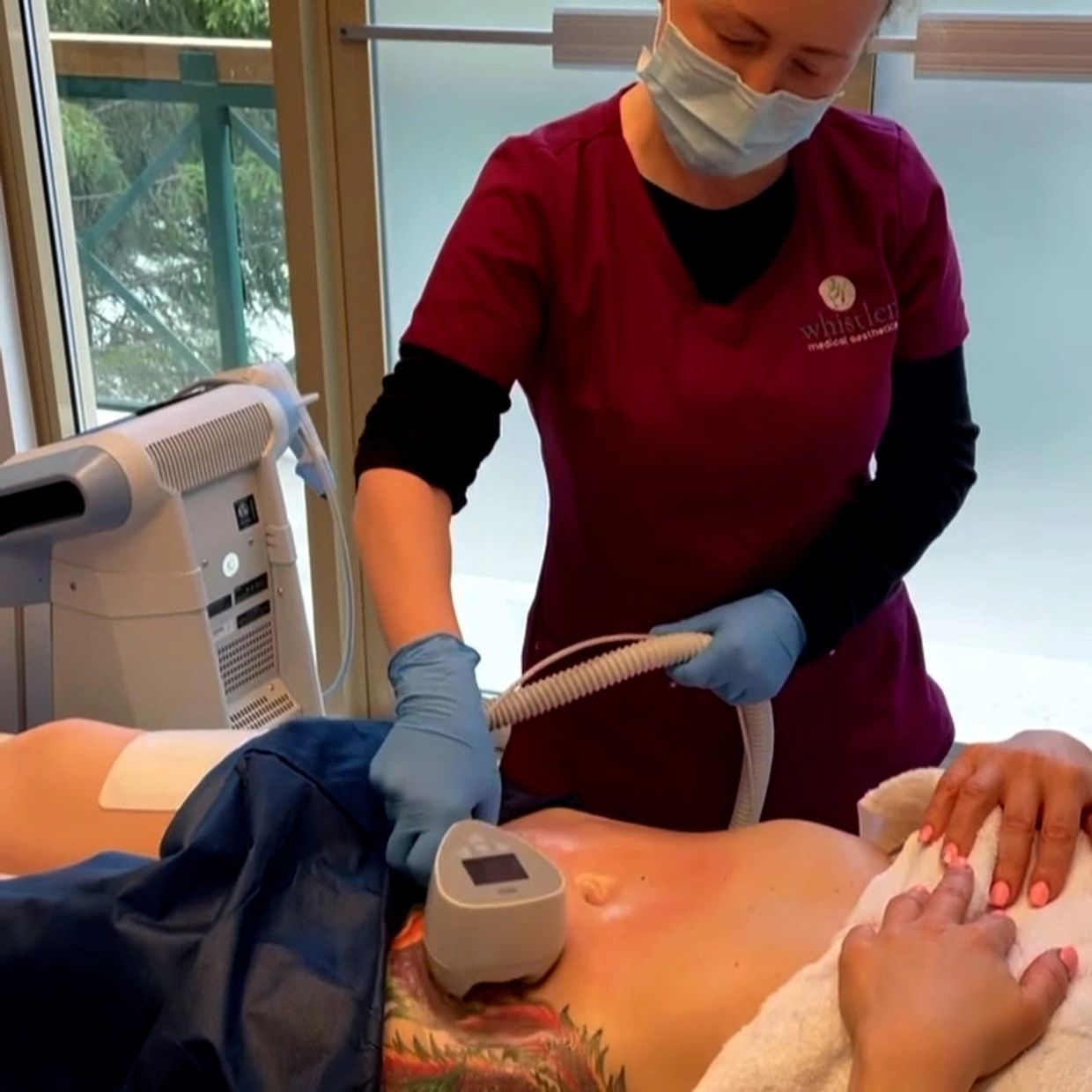 Dr. Sarah Kennea treating a patient with Exilis Ultra 360