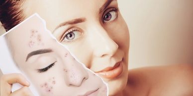 CIRUJANO PLÁSTICO 
CLÍNICA ESTÉTICA 
DERMATÓLOGO
limpieza facial
manchas
acné
hidratación facial
SPA