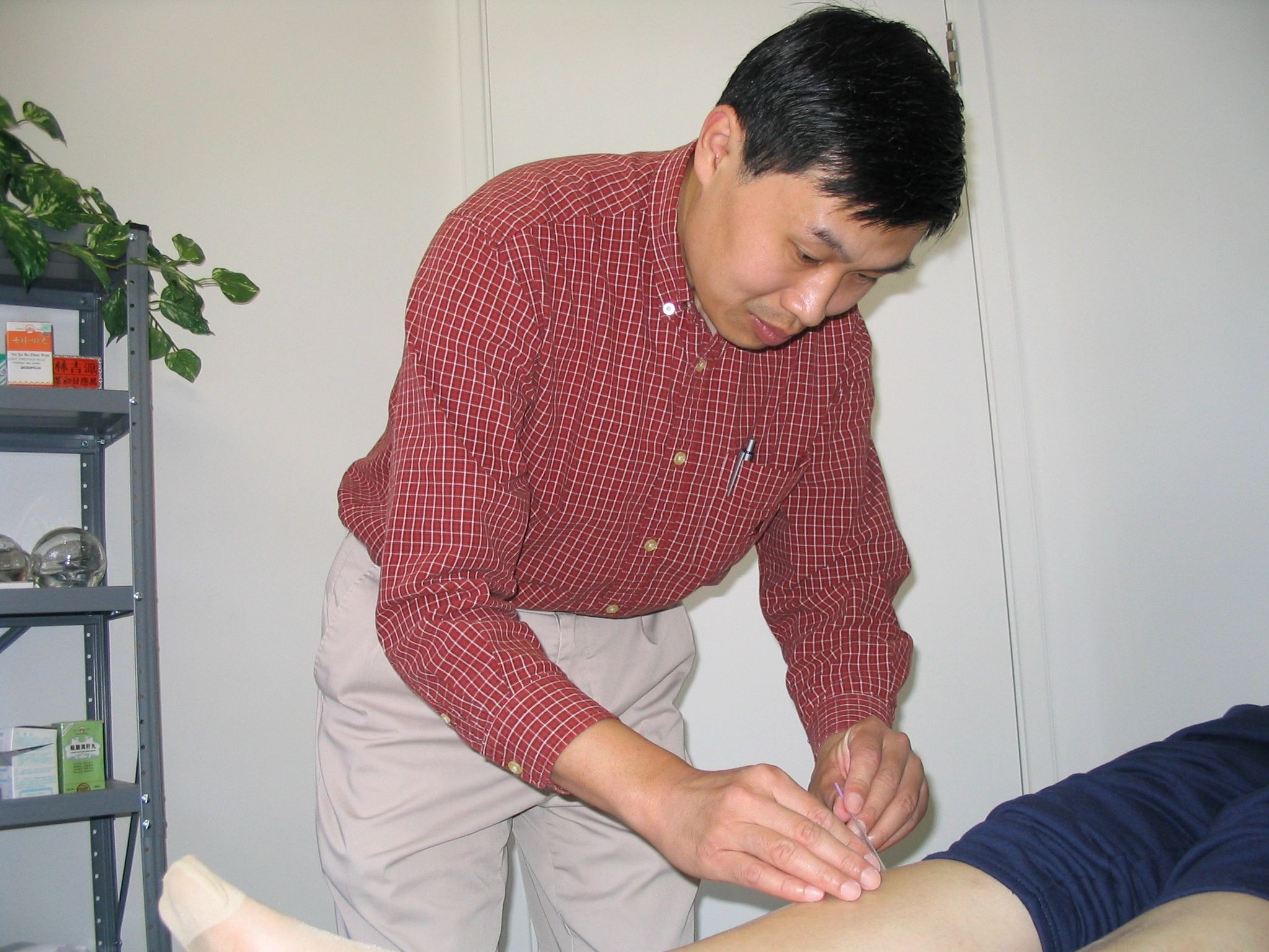 Acupuncture Wei Huang Acupuncture