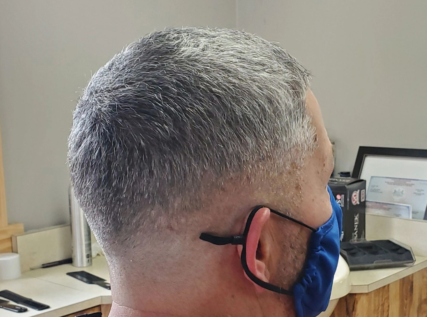Mastering Bald Type Fades: Stylish Hair Loss Solutions