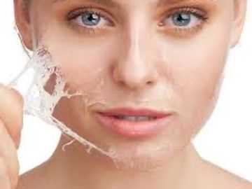 chemical peel