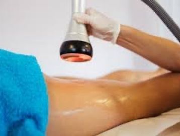 cellulite treatment 