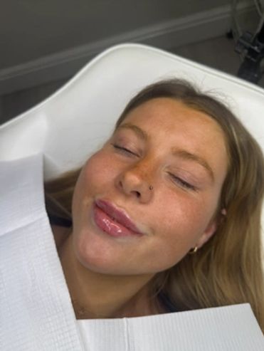 Young woman with glossy lips relaxing in a dental chair.
