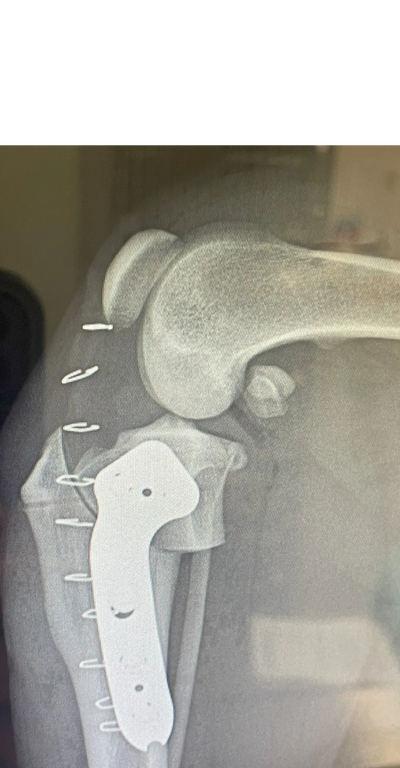 Slocum TPLO plate placed on healing tibia