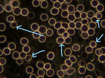 Detoxing (live blood analysis)