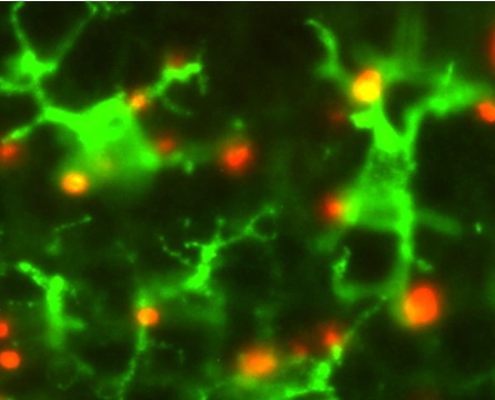 Specialized cells in the skin, called antigen presenting cells with the particles.