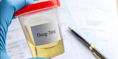 A gloved hand holding a urine sample container labeled 'Drug-Test'.