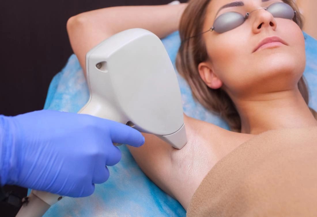 Laser Hair Removal Procedure