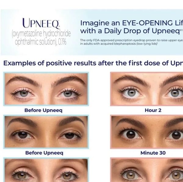 Before and after images showing eye-opening results with Upneeq drops.