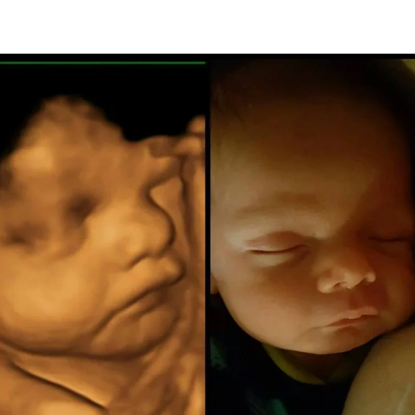 what-is-a-4d-ultrasound-scan-how-it-works-2-the-pulse-57-off