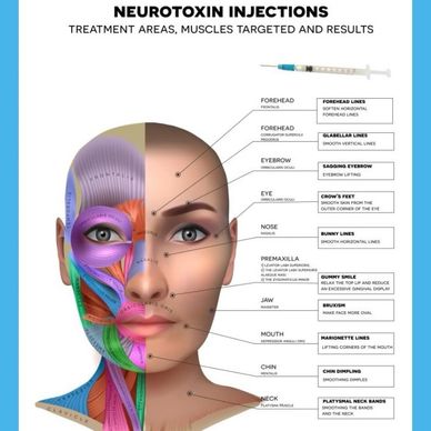Botox frown, forehead, crows feet, brow lift, hooded eye lids, gummy smile, jaw slimming, square jaw