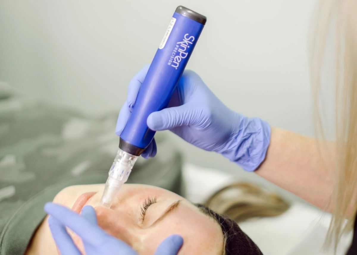 The SkinPen® microneedling device