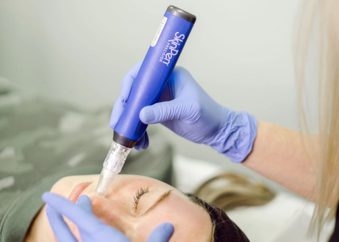 A clinician performing a SkinPen® microneedling treatment on a patient's face