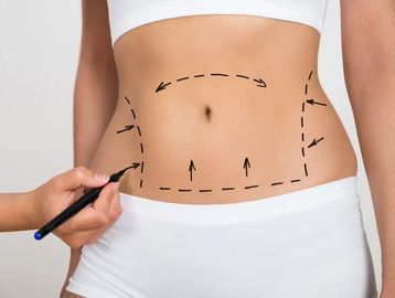 post-surgical massage, lymphatic drainage, liposuction, mommy makeover, akkary surgical center, 