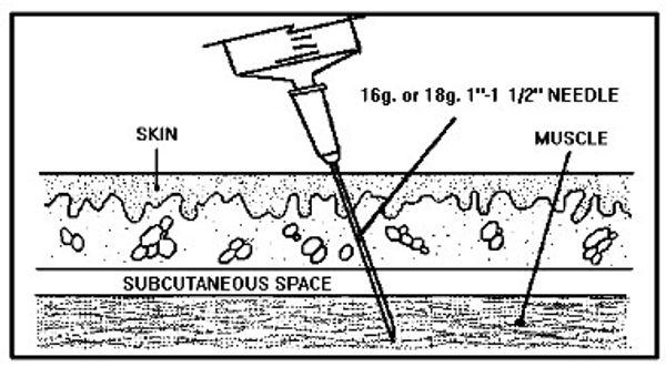 picture showing an intermuscular injection