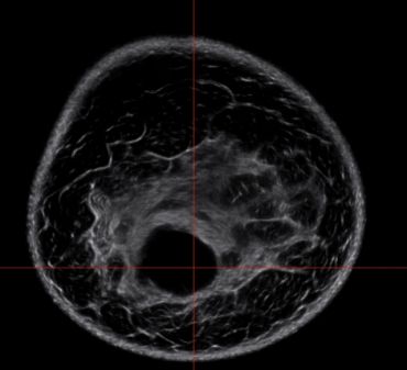 MRI scan showing a cross-sectional view of a human brain.