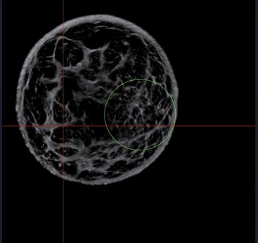 3D medical scan showing detailed internal structures.