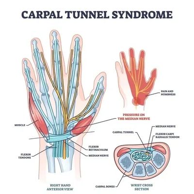 anatomy of carpal tunnel syndorme
