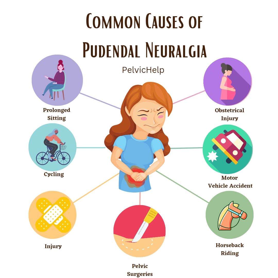 Common Causes of Pudendal Neuralgia