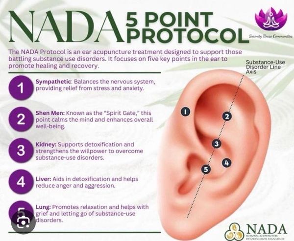 Diagram of NADA 5 Point Protocol for ear acupuncture to support substance use recovery.