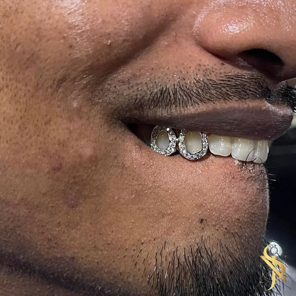 White Gold Grillz Hand Set With VVS Diamonds 