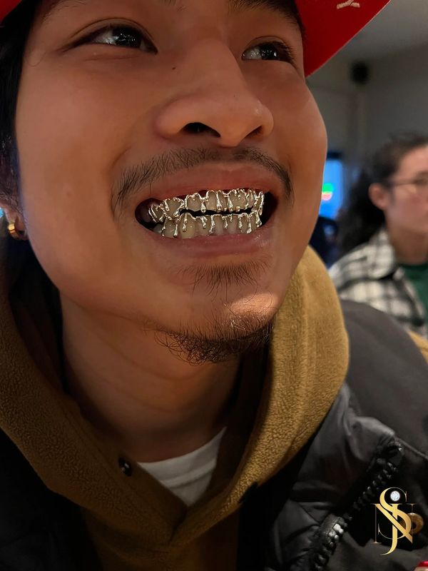 Custom Drip Set Grillz In Silver