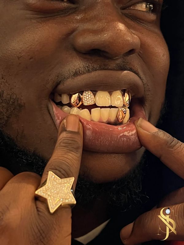 Custom Rose Gold Grillz Hand Set With VVS Diamonds