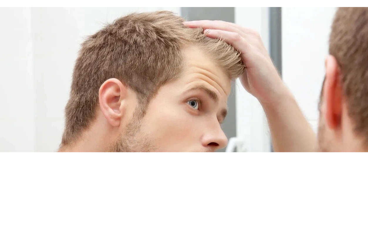 Hair transplant