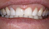 Cosmetic Dentist Wilmington