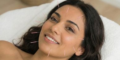 A woman receiving facial acupuncture with needles placed on her face.