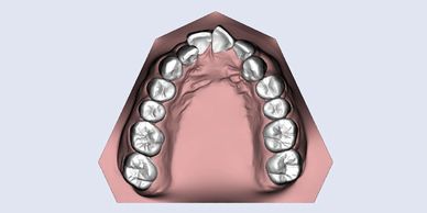 3d model of teeth and gums