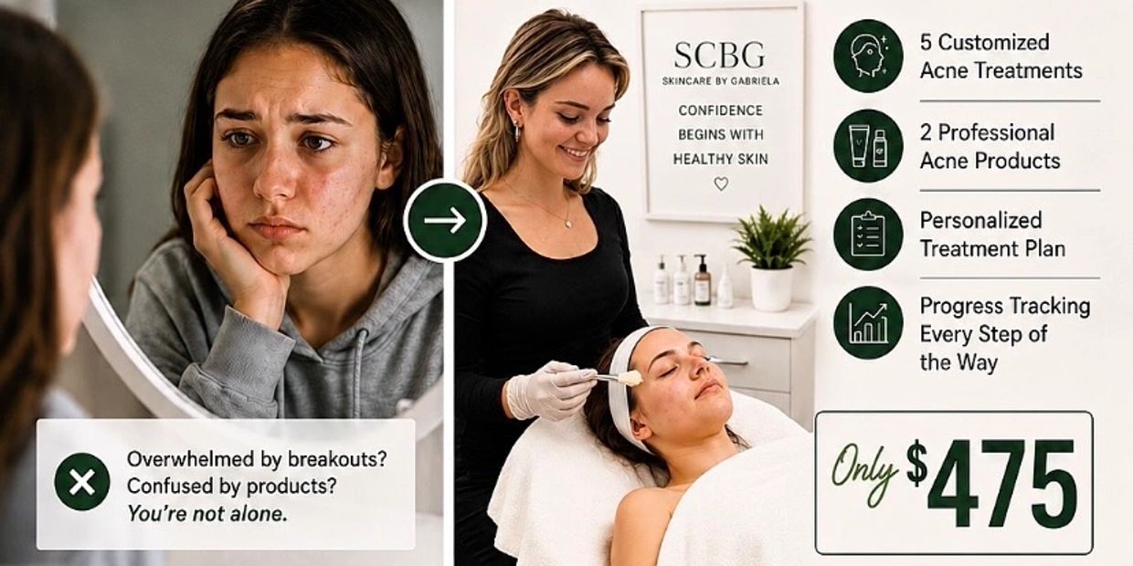 Acne Bootcamp offers customized treatments and personal plans for clear skin.