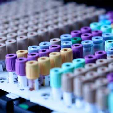 In vitro Diagnostic testing