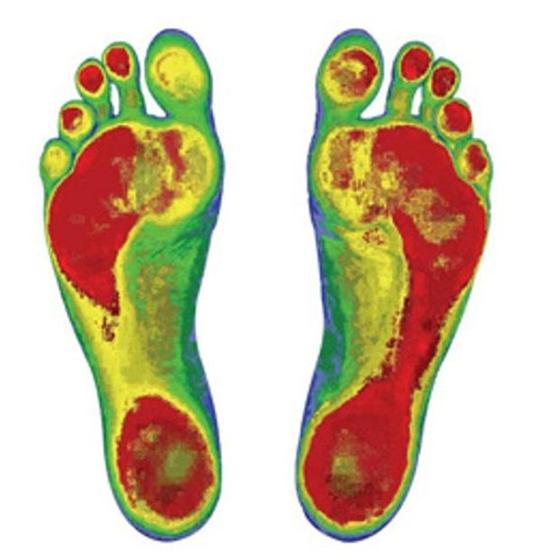 Footmaxx Custom Orthotics