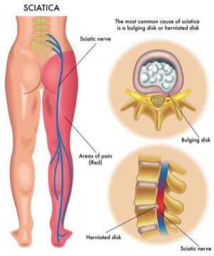 Related image