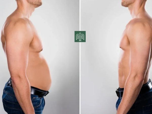 Real Patient with real weight loss result. Check out ICARENP today. 
