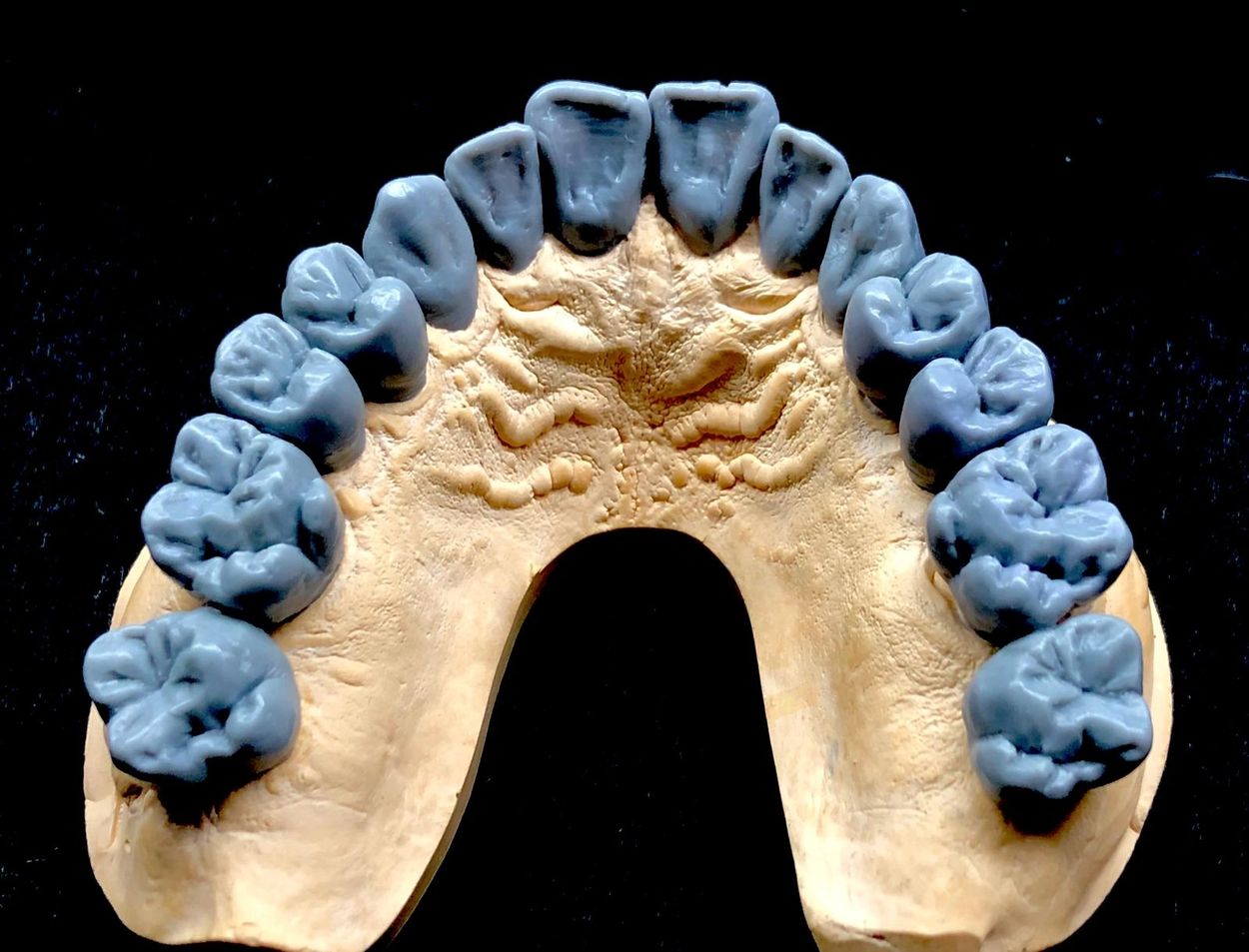 PFZ Crowns