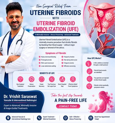 Uterine fibroid embolization procedure


Non-surgical fibroid treatment in Lucknow


UFE treatment b