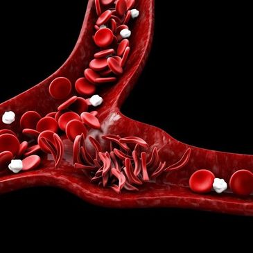 Illustration of blood cells flowing through a blood vessel with some sickle cells.