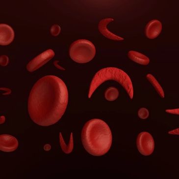 Various red blood cells, including sickle-shaped cells, floating in a dark background.