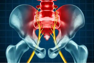 Massage therapy treatments for Sciatica at Tranquility Health in Victoria BC