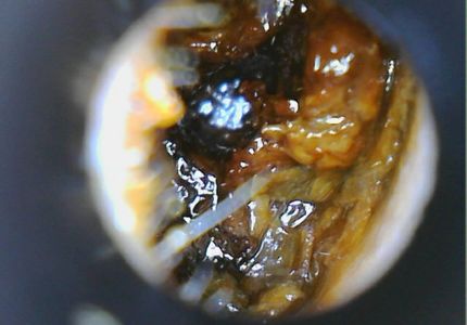 Wax build up