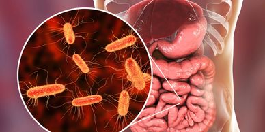 Gut Health, Weight Gain, Nutrition, Brain Health