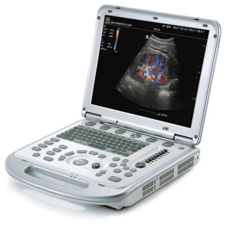 Advanced Imaging Mobile Ultrasound image 2