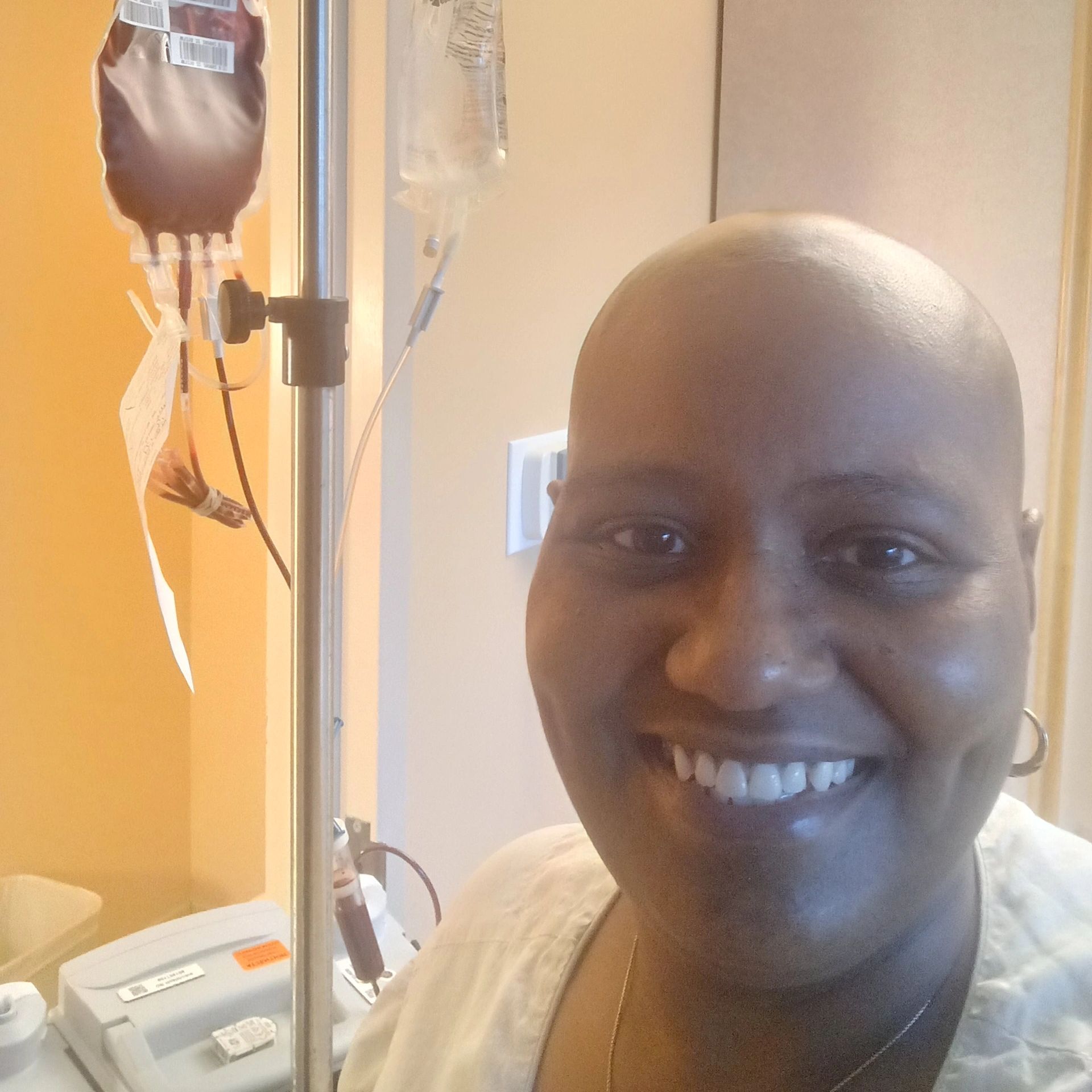 Jada in hospital recieving chemotherapy for Acute Myeloid Leukemia  2023.