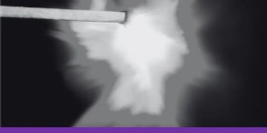 A matchstick igniting a flame