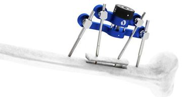 TTT device - The spider