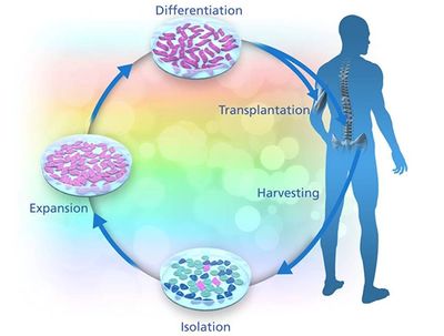 BrainStorm's NurOwn stem cell manipulation process 