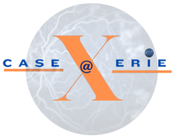 casexerie.com