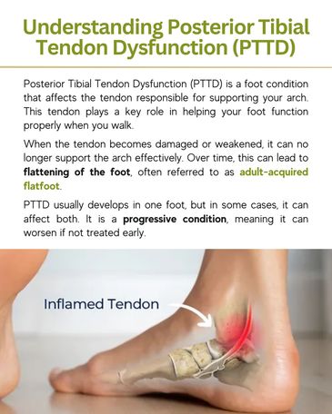 Diagram explaining Posterior Tibial Tendon Dysfunction and its effects on the foot.